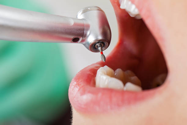 Best Pediatric Emergency Dentist in Lynchburg, MS